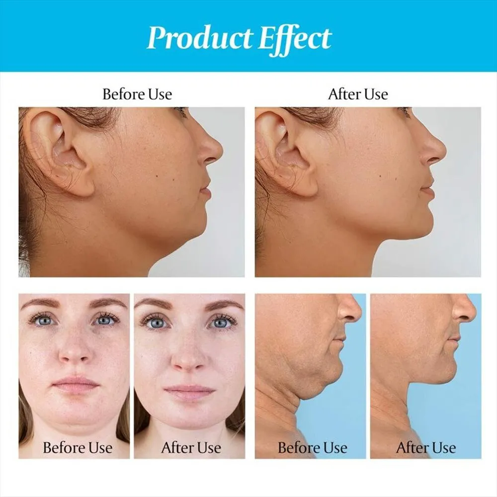 Ejercitador De Mandibula Tonificador Facial Muscular
